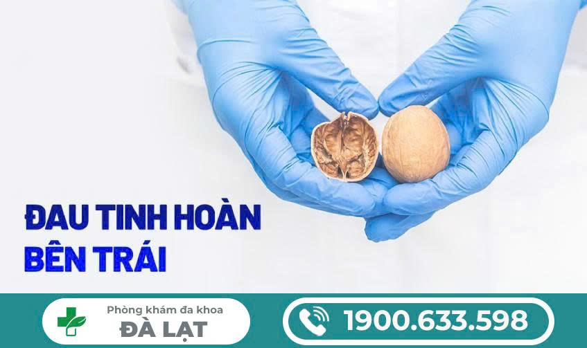 Hình ảnh minh họa